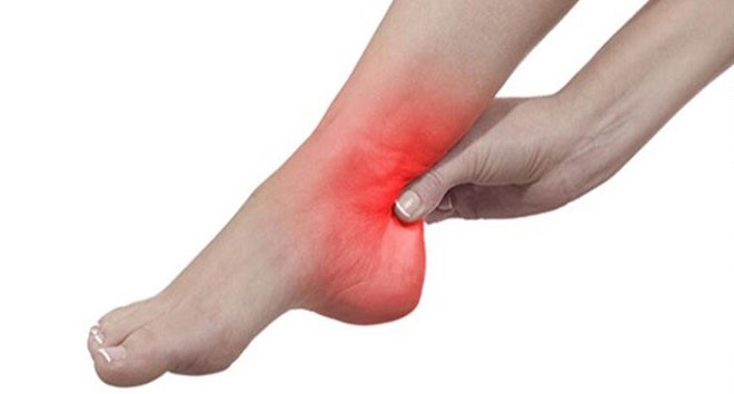 Sık ayak bileği burkulması kıkırdak hasarlarını artırıyor Sık ayak bileği burkulması kıkırdak hasarlarını artırıyor