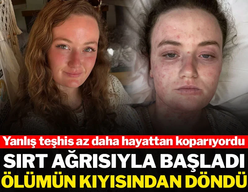 Sırt ağrısıyla başladı, ölümün kıyısından döndü: Yanlış teşhis hayattan koparıyordu Sırt ağrısıyla başladı, ölümün kıyısından döndü: Yanlış teşhis hayattan koparıyordu
