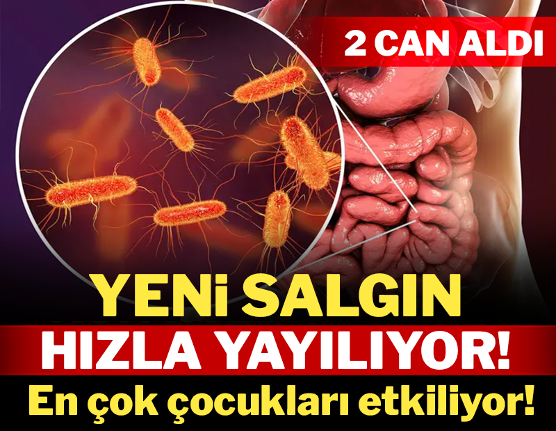 Yeni salgın 2 can aldı: En çok çocukları etkiliyor! Yeni salgın 2 can aldı: En çok çocukları etkiliyor!