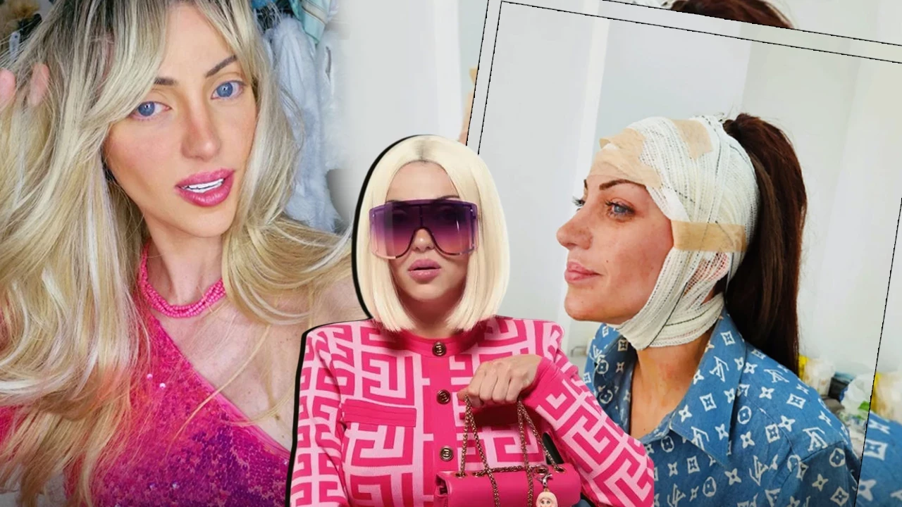 Barbie sevdası canından etti! 27 ameliyat geçirdi Barbie sevdası canından etti! 27 ameliyat geçirdi