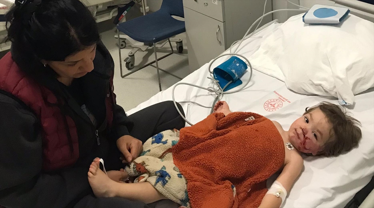 Başkentte pitbull cinsi köpeğin saldırısına uğrayan 2 çocuk yaralandı Başkentte pitbull cinsi köpeğin saldırısına uğrayan 2 çocuk yaralandı