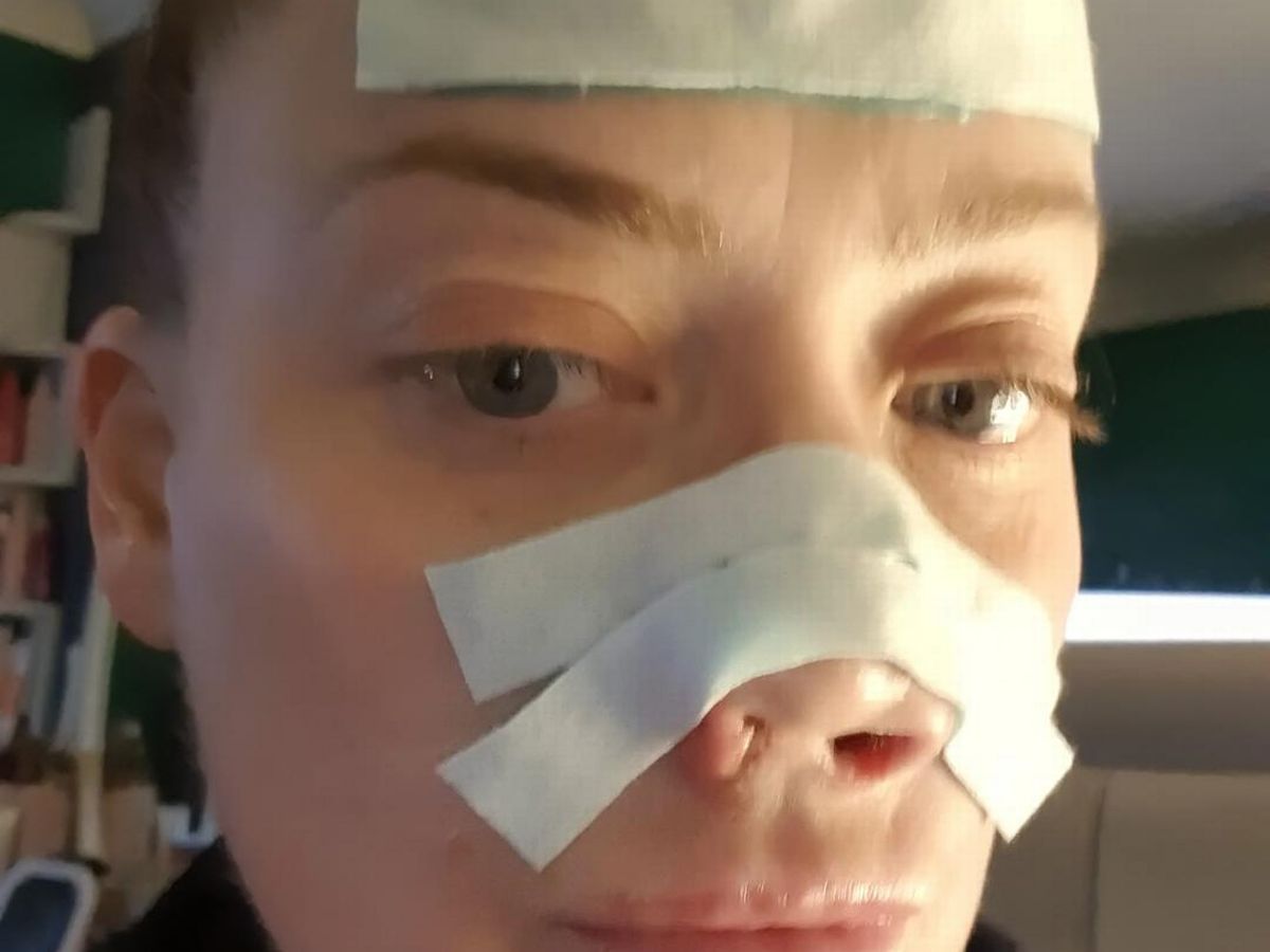 Antalya tatilinde dişlerini yaptıran turistin burnu çöktü! Antalya tatilinde dişlerini yaptıran turistin burnu çöktü!