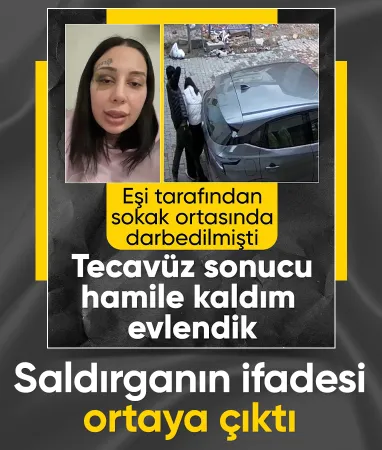 İstanbul’da eşini sokak ortasında darbeden şahıs: Burun estetiği yaptırıp boşanmak istedi