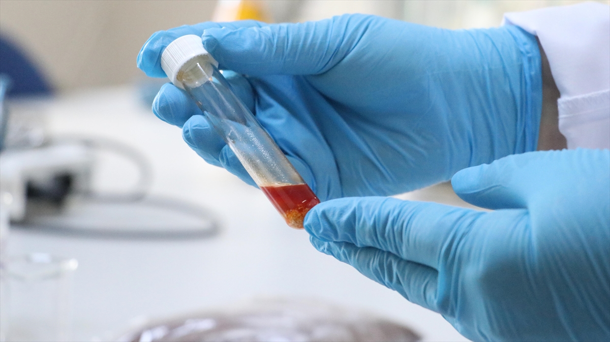 Tekirdağ’da üzüm atığından yüksek değerli tek hücre yağı üretildi Tekirdağ’da üzüm atığından yüksek değerli tek hücre yağı üretildi