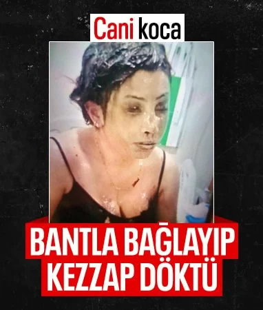 Gaziantep’te eski eş dehşeti: Başından aşağı kezzap döktü…