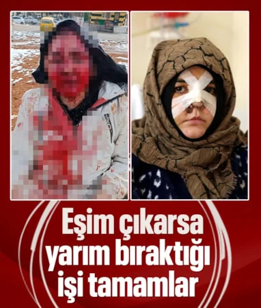 Gaziantep’te eşinin dövdüğü kadın feryat etti… Gaziantep’te eşinin dövdüğü kadın feryat etti…