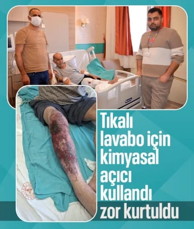 Ağrı’da lavabo giderini açmak isterken yandı…