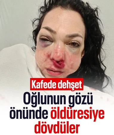 Kocaeli ‘de gittikleri kafede anne ve oğlu darbedildi… Kocaeli ‘de gittikleri kafede anne ve oğlu darbedildi…