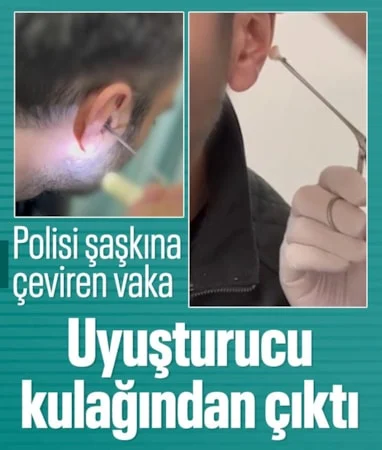 Kayseri’de şaşırtan yöntem: Uyuşturucuyu kulağında sakladı…