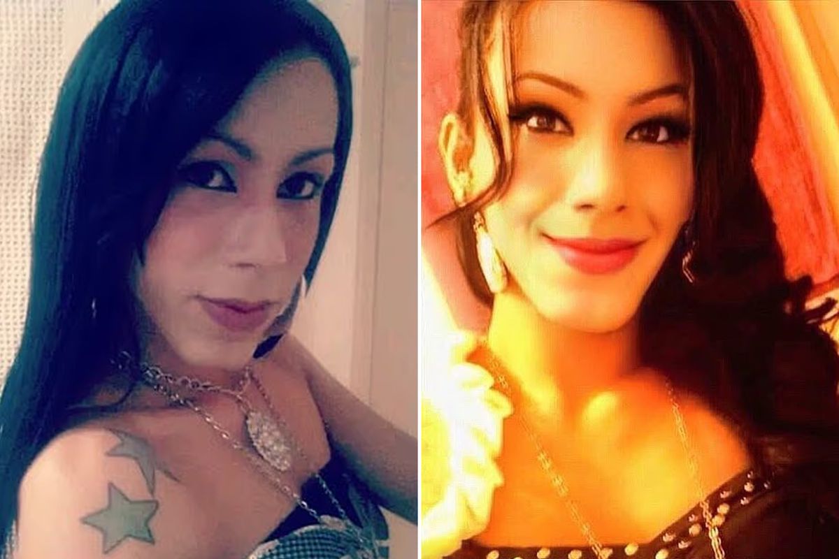 Güzellik uğruna yüzü tanınmaz hale geldi! Yine akıllanmadı…