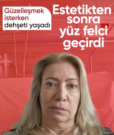 Ankara’da estetik yaptıran kadın yüz felci geçirdi…