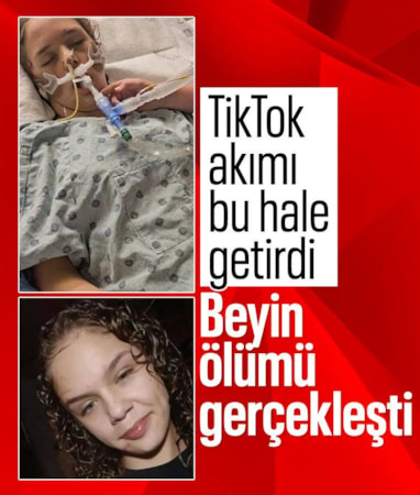 ABD’de Tik Tok akımı kabusu: Kalbi durdu, beyin ölümü gerçekleşti… ABD’de Tik Tok akımı kabusu: Kalbi durdu, beyin ölümü gerçekleşti…