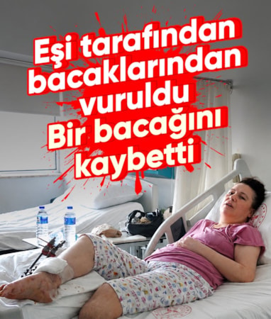 Muğla’da boşanma aşamasındaki eşi tarafından vurulan kadın bir bacağını kaybetti… Muğla’da boşanma aşamasındaki eşi tarafından vurulan kadın bir bacağını kaybetti…