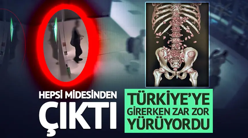 Yürümekte bile zorlanınca yakayı ele verdi…