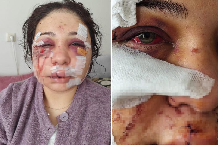 Polis memuru kocasının öldüresiye dövdüğü kadına hapis şoku…