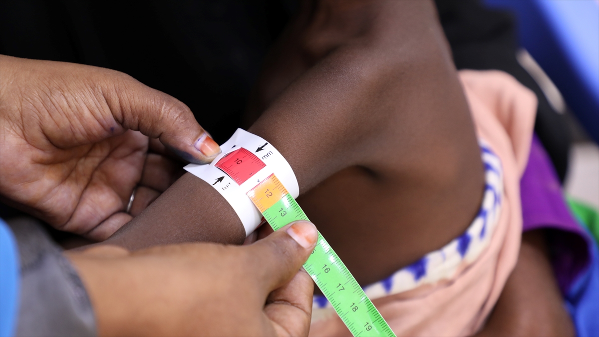 UNICEF, insani yardımların kesildiği Somali’de en büyük bedeli çocukların ödediğini bildirdi UNICEF, insani yardımların kesildiği Somali’de en büyük bedeli çocukların ödediğini bildirdi