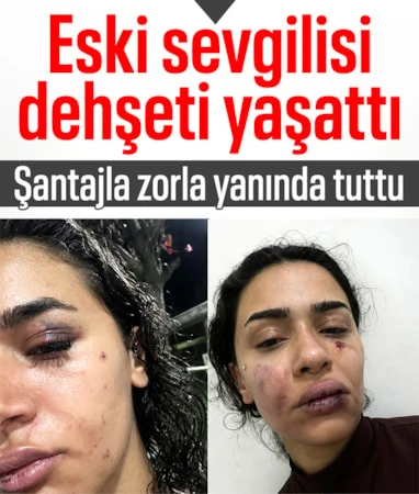 İstanbul’da eski sevgilisi tarafından darbedildi…