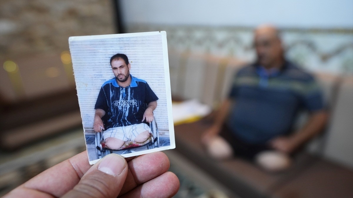 ABD ordusunun çekildiği Irak’ta siviller kaybettikleri uzuvlar ve işgalin travmasıyla yaşıyor